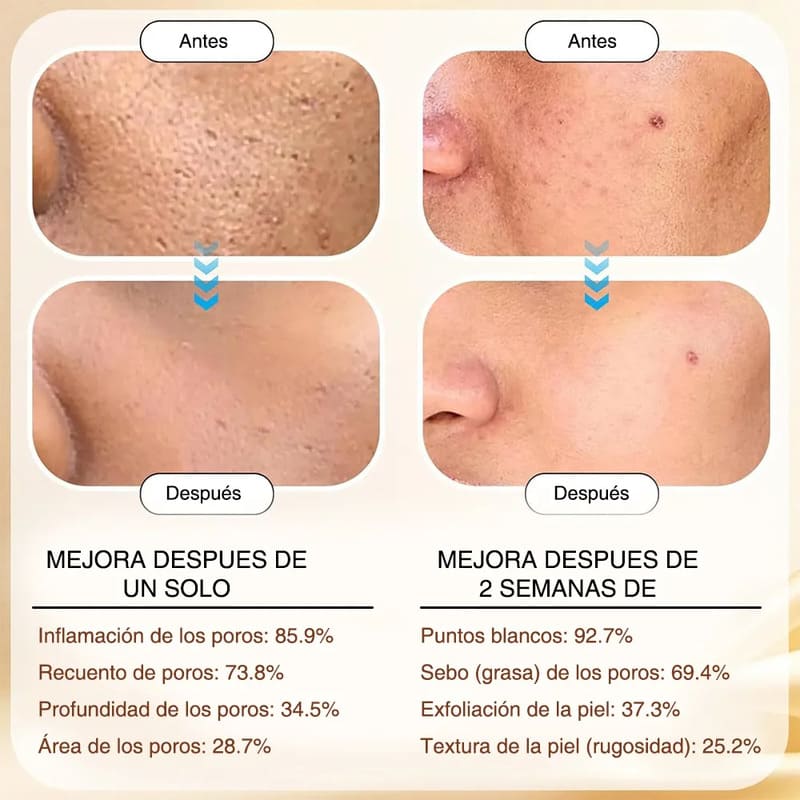 Duo de suero esencia facial arroz - Image 5